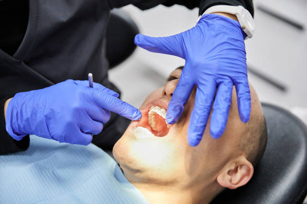 Best Urgent Care for Lost Fillings or Crowns in Jonesboro, GA